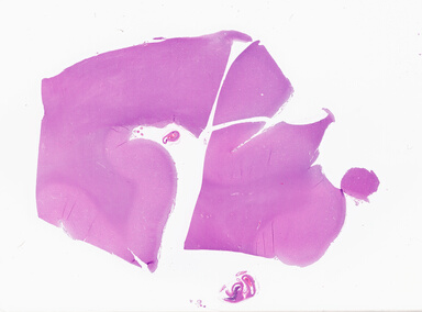 ['deident_9bca40ac-bb32-4820-9f39-939bbaa6dc2a_69b063bf.jpg']