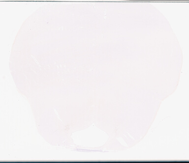 ['deident_10bdb55f-3b4c-43d2-9cd0-69c0c98db026_69b06380.jpg']