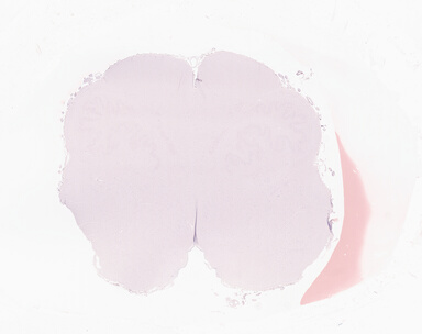 ['deident_f42f0f62-3028-484e-89de-c9f4e84aeb68_69b063e2.jpg']