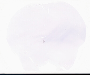 ['deident_41fec6f0-f85e-412b-a655-601b173c3c92_69b06399.jpg']