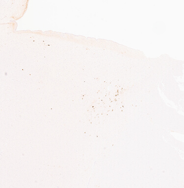 ['deident_970c6962-9f9d-4f08-9b97-8fcd74c25a5d_69b06029.jpg']