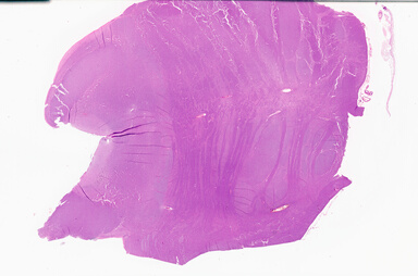 ['deident_213f87a0-dab0-449c-803d-0329edb26448_69b05feb.jpg']