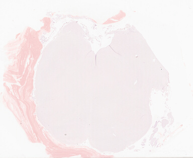 ['deident_baef6313-9ab3-437e-84b1-cbff80b812c7_69b0603d.jpg']