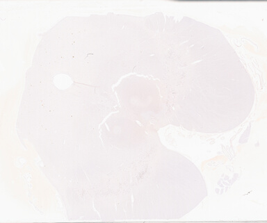 ['deident_e344745f-1198-4fa0-9b08-9a5d701719cc_69d93716.jpg']