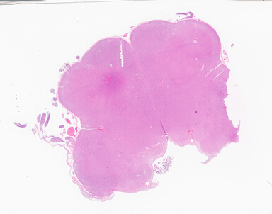 ['deident_c8acdf85-d515-4f96-b9fb-83f98fa78e85_69d9370b.jpg']