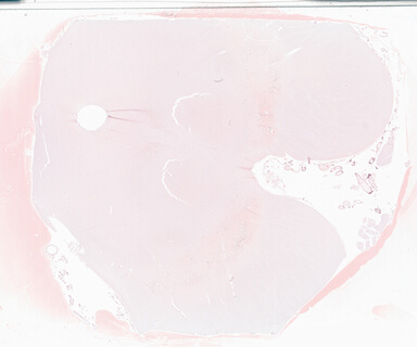 ['deident_ed0925ba-b155-4a40-86f6-20e3dc8089dd_69d9371f.jpg']