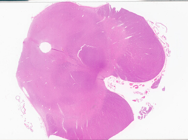 ['deident_bf7c9df5-b9c0-43ef-bcd9-04fd8719ac01_69d93701.jpg']