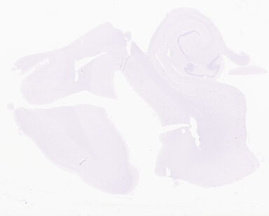 ['deident_b2a837ea-1084-4a4c-b52c-4defc7ce91ef_69d93e0e.jpg']