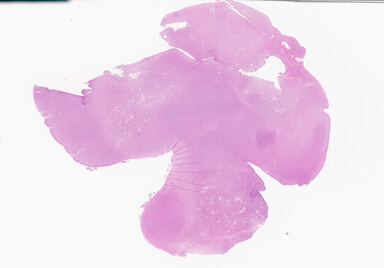 ['deident_728c8402-0a3d-45b1-8eec-4dfad75b4ad3_69d93de5.jpg']