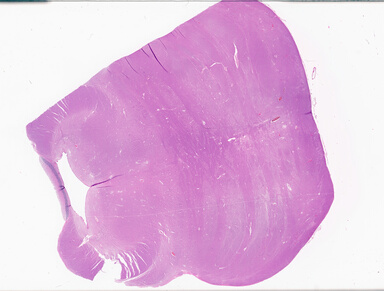 ['deident_9c7f5811-37b7-4a8c-82e0-976c760df03f_69d93df8.jpg']