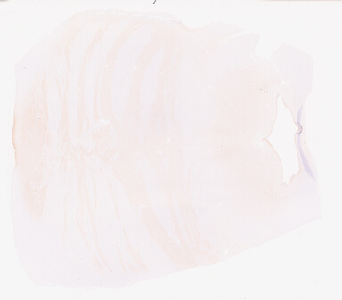 ['deident_9cc4aad7-3a36-4fad-bd42-6ed1082b4fb5_69d93dfa.jpg']