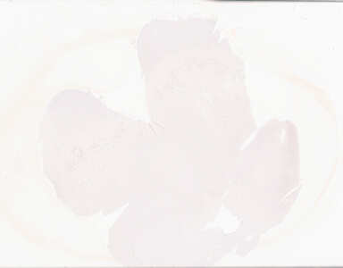 ['deident_45c3924b-0835-4a74-a54a-47d0d78c29ee_69d93dd5.jpg']