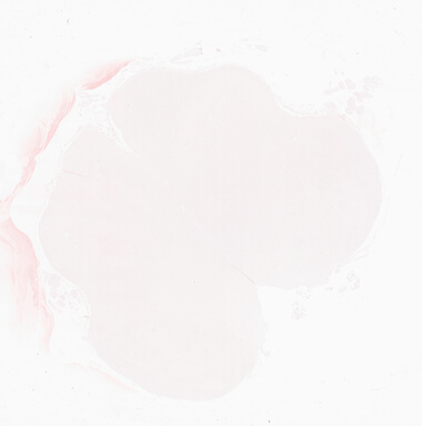 ['deident_80799f0b-dbba-4734-9429-2d949fcab339_69d93deb.jpg']