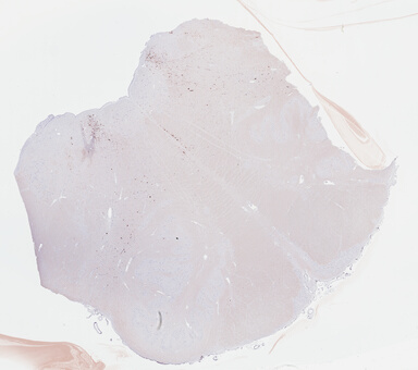 ['deident_2e01f99f-0775-4e0d-9c61-77bb821cbdd8_69b04c68.jpg']