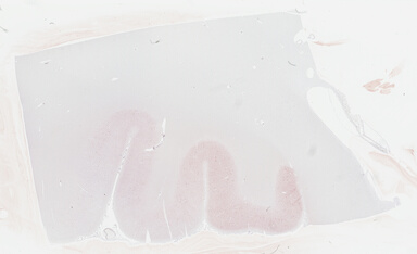 ['deident_b4b450e2-66fe-4b6e-b936-147a25479d52_69b04c96.jpg']