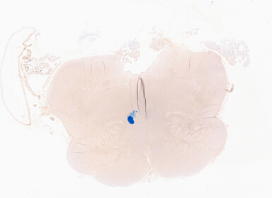 ['deident_597d1f6c-b8fc-41eb-b738-00d665c01de7_69b056f6.jpg']