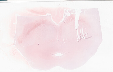 ['deident_645230c5-c18c-48f2-8712-2bcc4cda9227_69b056ff.jpg']