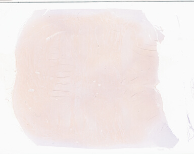 ['deident_d872b5b1-de05-48dd-8ae0-50745e3dac6c_69b05746.jpg']