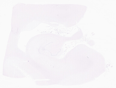 ['deident_864cefdb-73d3-41e3-8569-9df2f7e11e88_69b05713.jpg']