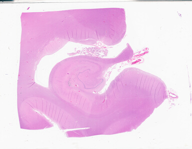 ['deident_49054a83-9fef-415e-a828-46cc6c43d1b2_69b056e7.jpg']