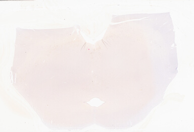['deident_6760edab-3d6d-4444-8fdc-e2f277e61003_69b05703.jpg']