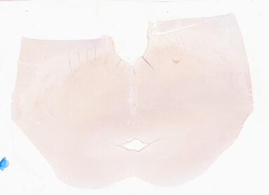 ['deident_11e05970-c60b-4282-82aa-d44a2038f3aa_69b056d0.jpg']