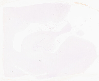 ['deident_69c4379b-c18d-483f-aae9-a0dab38972d1_69b05706.jpg']