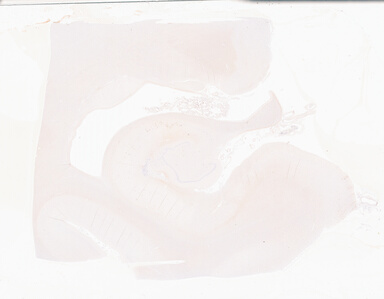 ['deident_1c787c02-cad6-4f2c-844f-a63729ec98dc_69b056d4.jpg']