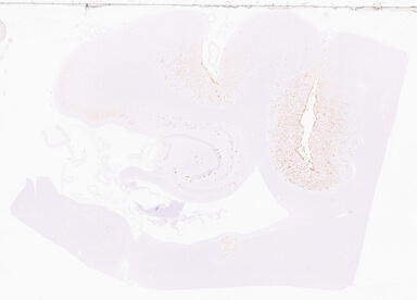 ['deident_2fdf7464-5ba5-4389-b04c-1a9827ecd473_69d95727.jpg']