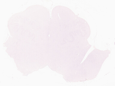 ['deident_77f59f49-35d1-4a65-981a-ab81a23667ea_69d95749.jpg']