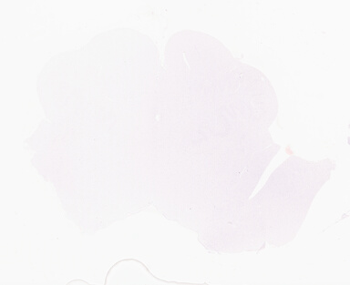 ['deident_5366da34-d557-41ff-ab03-67205fd9dfea_69d95733.jpg']