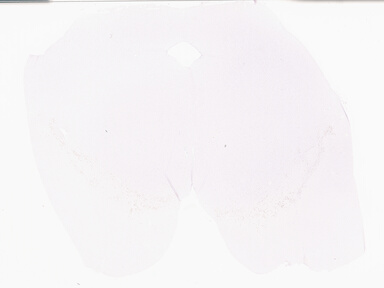 ['deident_ab090717-f3b1-4248-91aa-1cac0d94e3fe_69d95769.jpg']