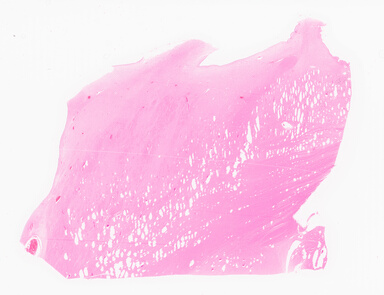 ['deident_ee3b47ac-ff1b-457a-b457-c0d29567630a_69d9578e.jpg']