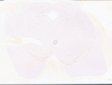 ['deident_ca529968-3c52-476d-84fd-a0a3f3c49afc_69d9577f.jpg']