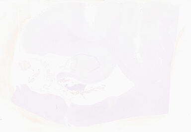 ['deident_bb172be1-57b4-4c89-b8c2-2a71883b4e1d_69d95776.jpg']
