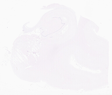 ['deident_43e1fce9-98b2-4f77-aed5-213678980f1a_69b05f0c.jpg']