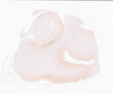 ['deident_3bf5979e-d065-4d32-b504-bef7131bda04_69b05f01.jpg']