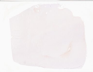 ['deident_5df84c71-d378-4d1c-a370-b6a73358a1c0_69b05c8f.jpg']