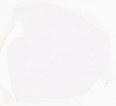 ['deident_0a7370e7-10f7-42e0-922a-c59c04f21ab8_69d955de.jpg']