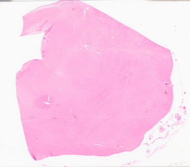 ['deident_ecadd75d-7ac2-4b75-8679-3f105e0bbe8a_69d9564e.jpg']