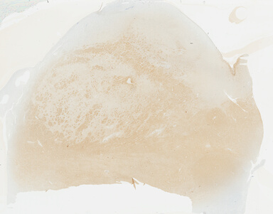 ['deident_d221c58f-a435-4d81-b24f-3784b4d1e5ea_695fc485.jpg']
