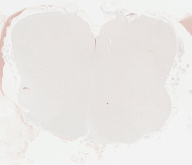 ['deident_f534fe29-f1f7-4fc9-9721-cebf92ce45f3_695fc49b.jpg']