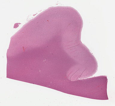 ['deident_d2b42ce8-ee64-49d3-a390-085bc7861ef8_69b0331b.jpg']