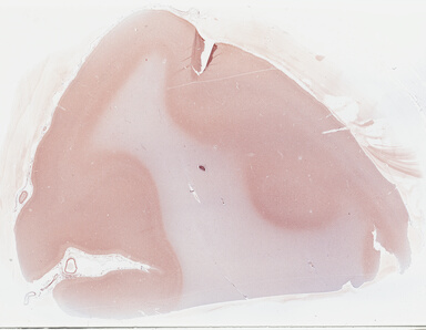 ['deident_f7a478ac-9069-468a-ab7c-cd437f228000_69b0332f.jpg']