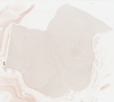 ['deident_32758ada-c050-405d-bd62-53369a178227_69b032f4.jpg']