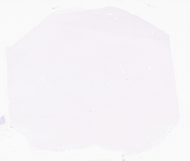 ['deident_168aea36-0d5a-485d-b0d4-fcf3c6383c6a_69b0430f.jpg']