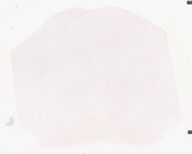 ['deident_57461b44-c7d5-4368-89cb-aeaa095eb820_69b0432b.jpg']