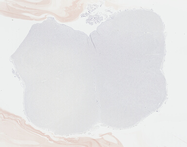['deident_220b16f6-25d0-4bd3-9067-f0372605d439_69b04316.jpg']