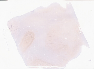 ['deident_bb1f8cf1-bd59-4ba1-a892-beef85c6c72b_69b052a3.jpg']