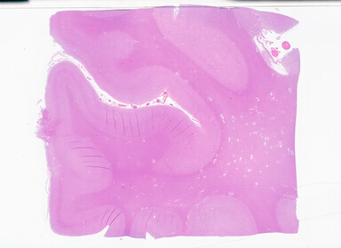 ['deident_4f638193-a1cb-4988-a5d6-c8a3e8ec6532_69b0526f.jpg']